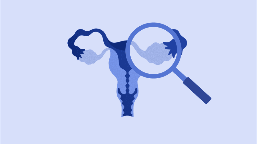 amh-high-ovage-body3