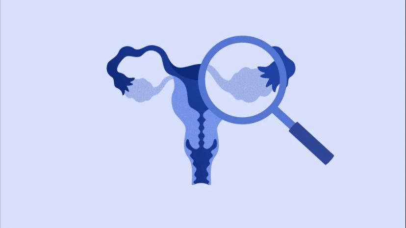 amh-high-ovage-body3