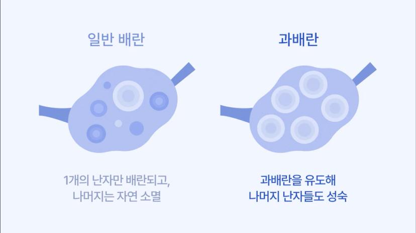 eggfreezing-misconceptions-body4