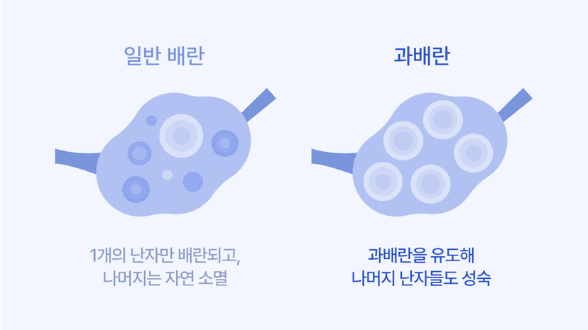 eggfreezing-misconceptions-body4