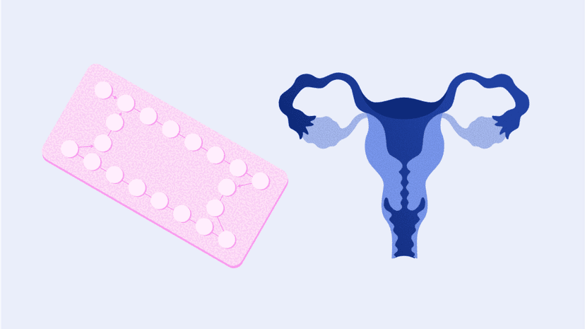 ovhealth-pill-infertility-body1