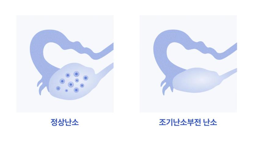 MenstruationLessBleedingCheckBody3