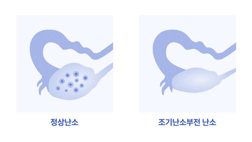 MenstruationLessBleedingCheckBody3